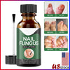 Anti Fungal Nail Treatment Nail Finger Toe Fungus Onychomycosis Remover