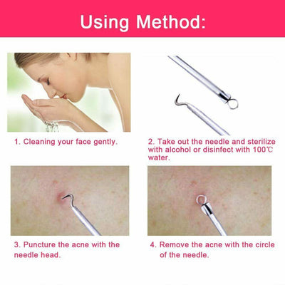 Ear Wax Remover Spoon Earwax Picker And Pimple Blackhead Remover Tools - COMBO KIT