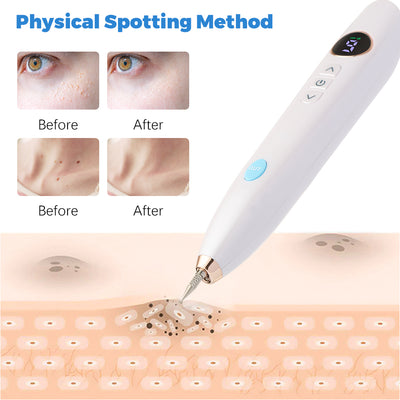 Laser Skin Tag Remover Face Mole Remove Plasma Pen Freckle Removal Machine Plasma Remove Scar Black Spot Face Wart Tattoo Device